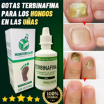 Anti hongo terbinafina